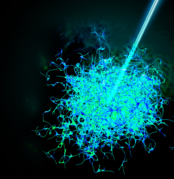 今天，我們把腫瘤的內(nèi)部「融穿」了