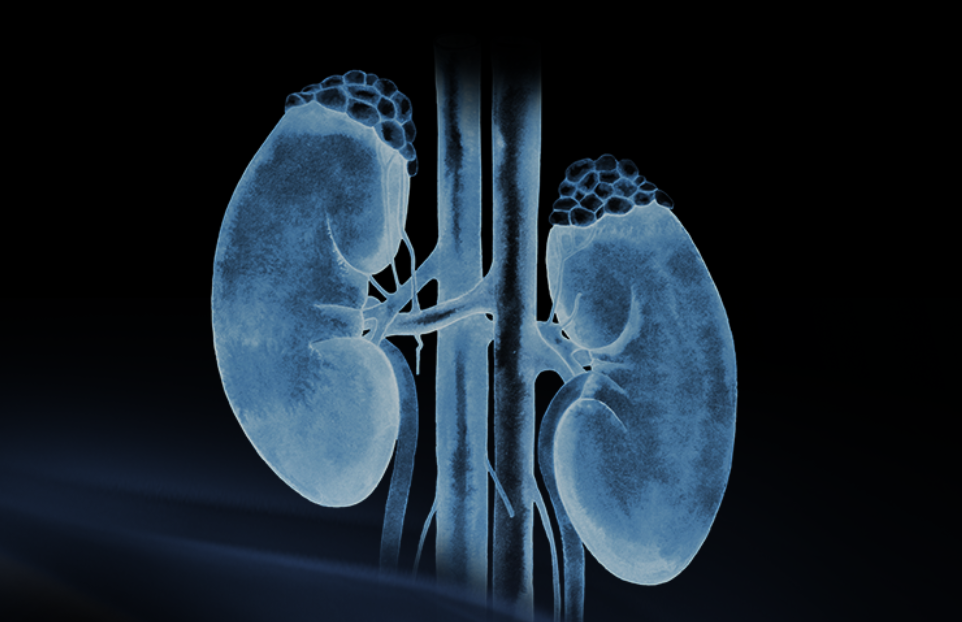 世界腎臟日 | 相得「腎」歡，融有術(shù)、精準(zhǔn)適形