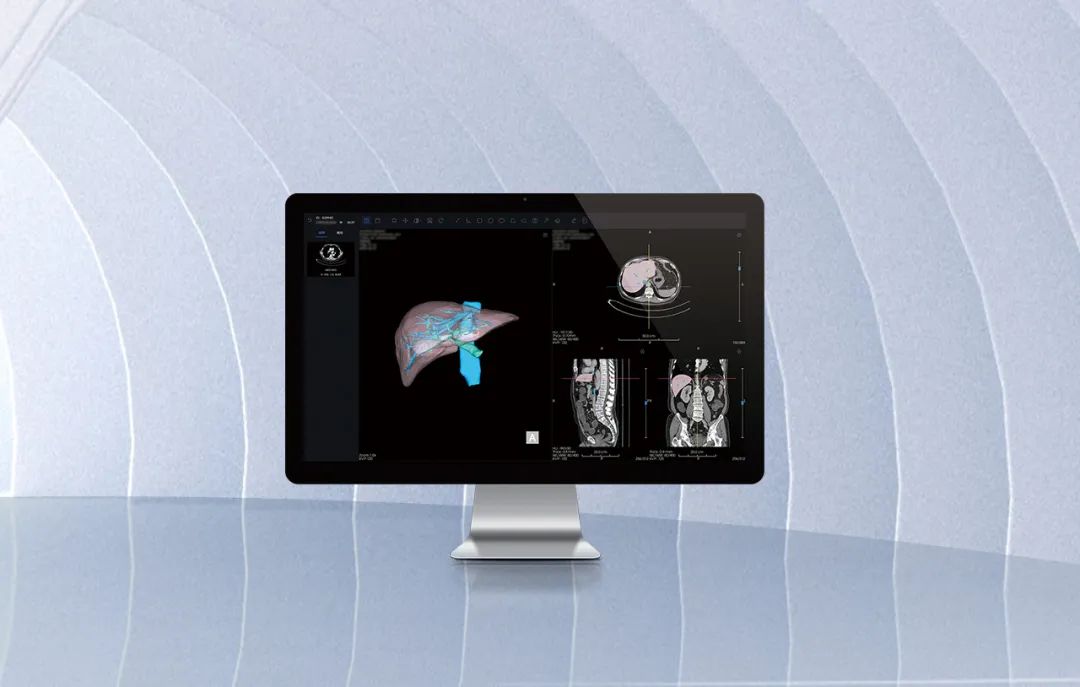 北京市首款！海杰亞醫(yī)療自主研發(fā)的AI+肝臟CT影像處理軟件獲批上市！